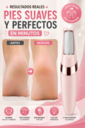 Removedor de Callos Flawless Eléctrico Recargable para Pies